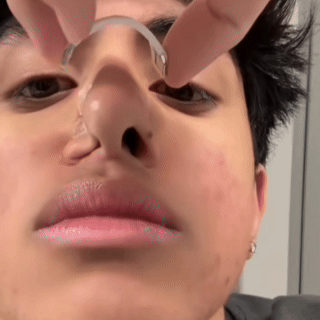 Dilatador Nasal OxyFlow™